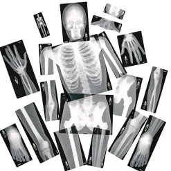 Human X-Rays - Set of 18