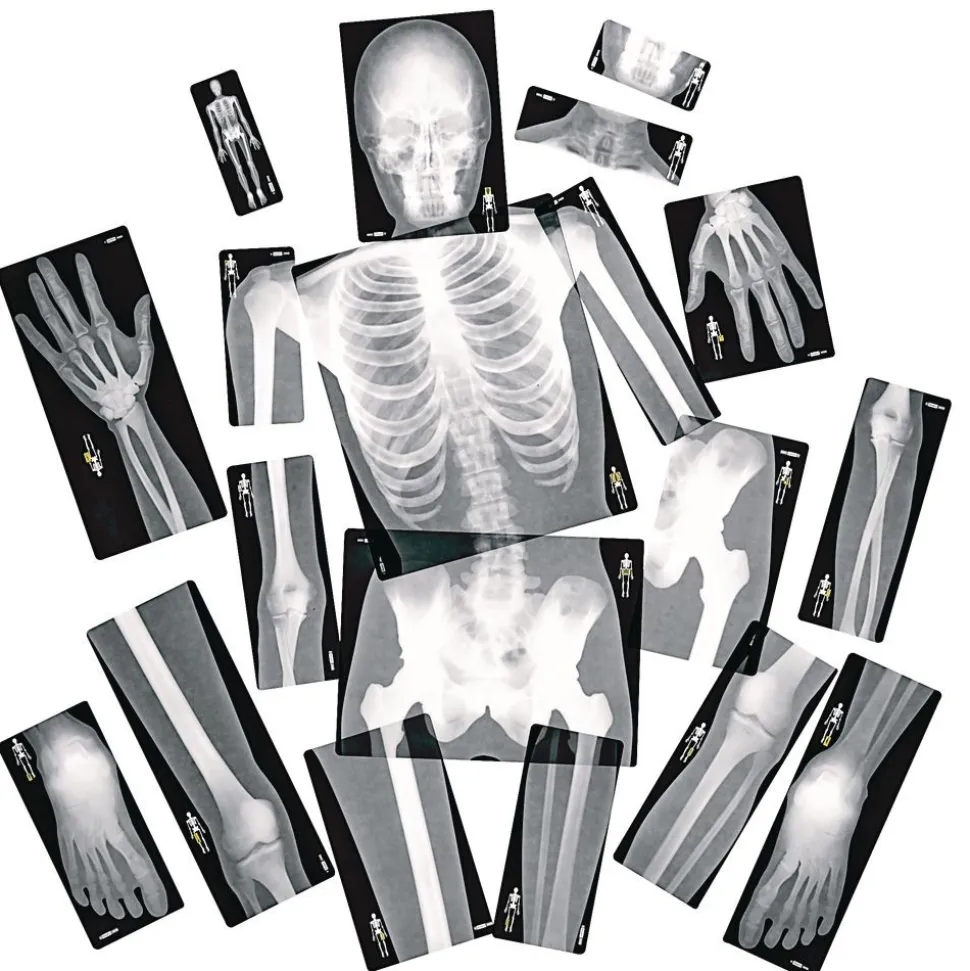 Human X-Rays - Set of 18
