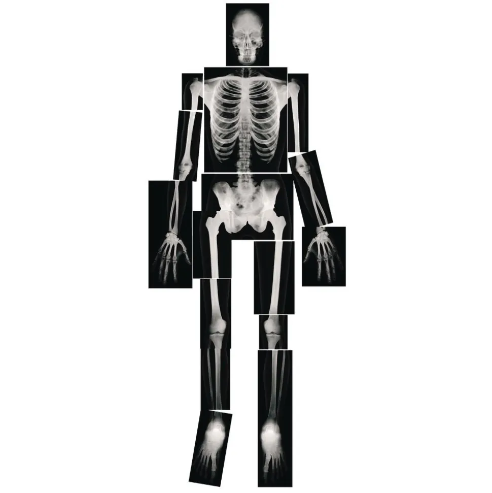 Human X-Rays - Set of 18