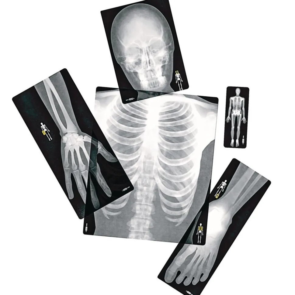 Human X-Rays - Set of 18