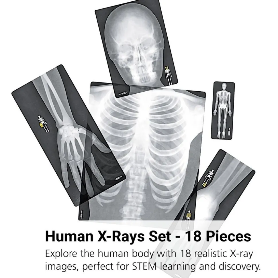 Human X-Rays - Set of 18